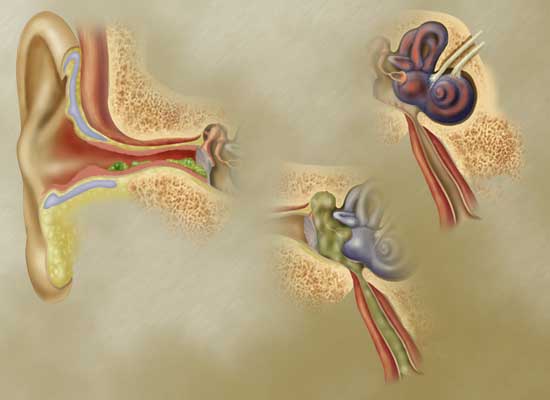 ear piercing infection symptoms. symptoms, ear infection