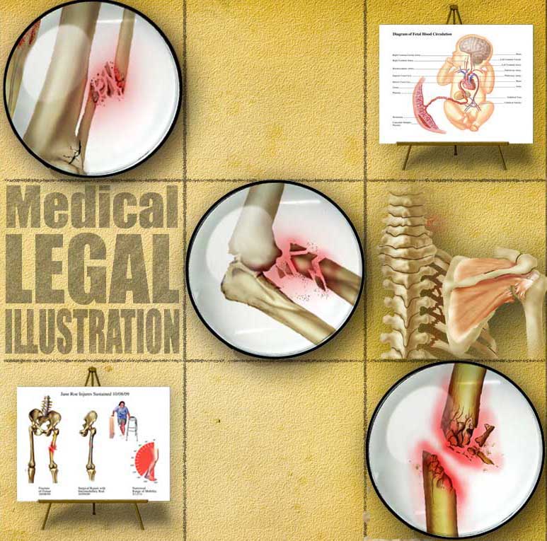 medical_legal