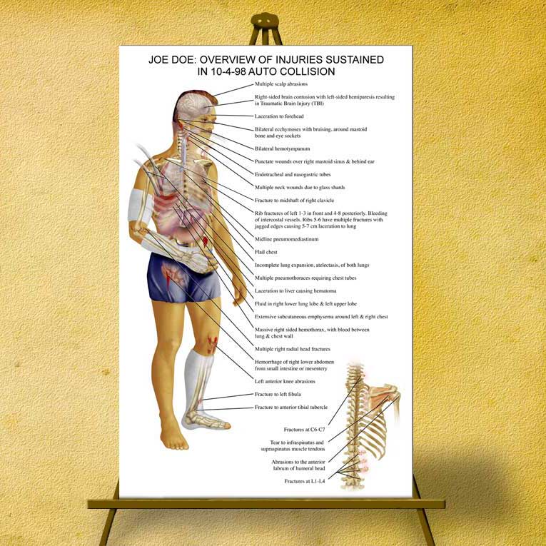personal_injury_illustration