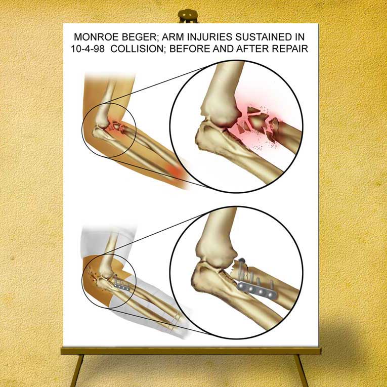 personal_injury_illustration