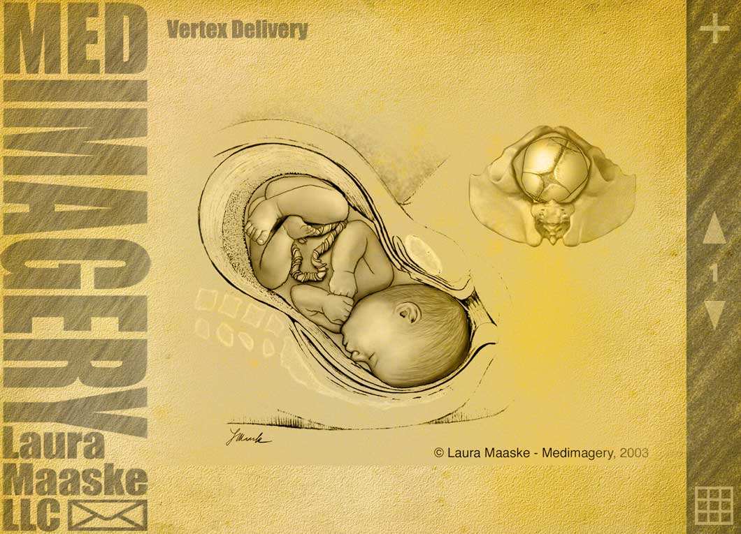 vertex